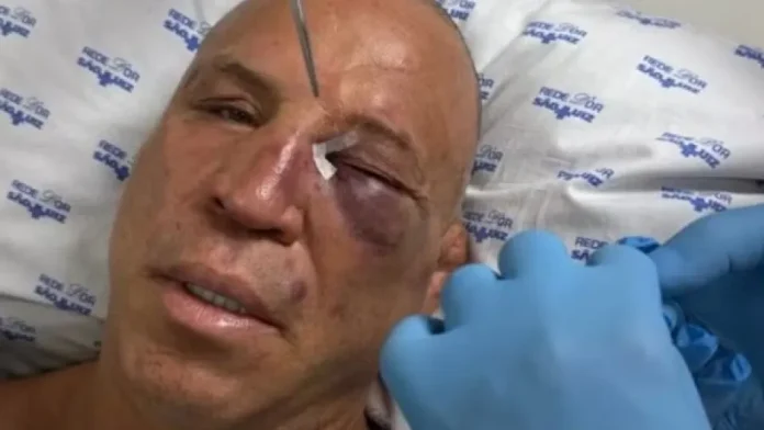 Com olho roxo, Wanderlei recebe alta após nocaute em pancadaria Com olho roxo, Wanderlei recebe alta após nocaute em pancadaria