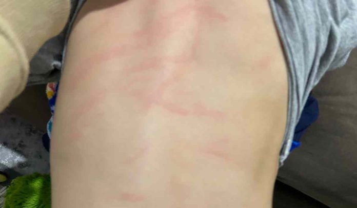 agressÃ£o a crianÃ§a em creche de Juiz de Fora foi denunciada