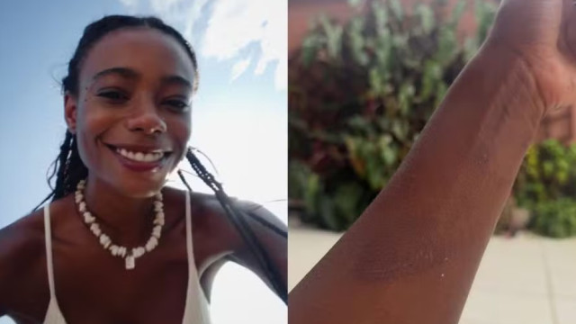 naom_6ade31e08f7c3.jpg Modelo mostra marcas pelo corpo após ficar três dias desaparecida